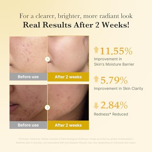 Medicube Kojic Acid Turmeric Niacinamide Serum (30ml) - wellkart