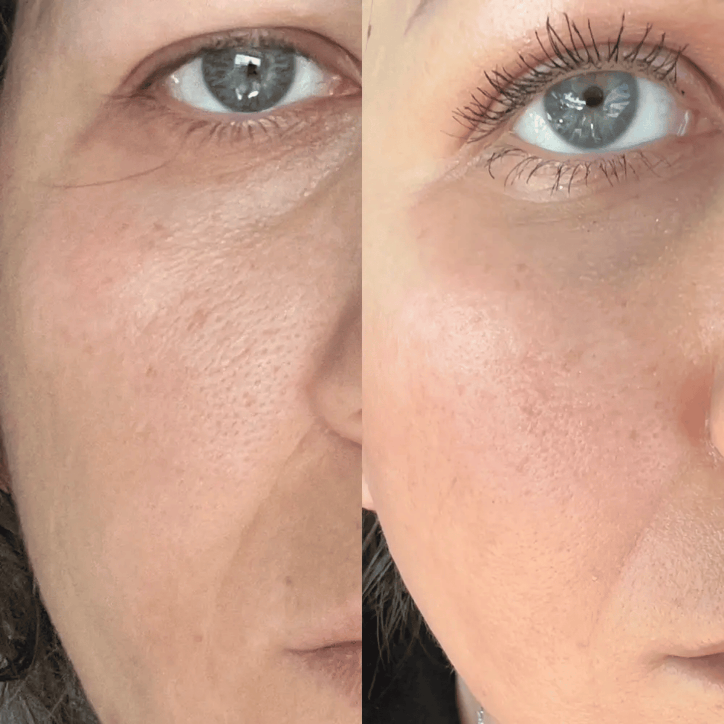 Medicube Zero Pore Cream 2.0 SkinStash