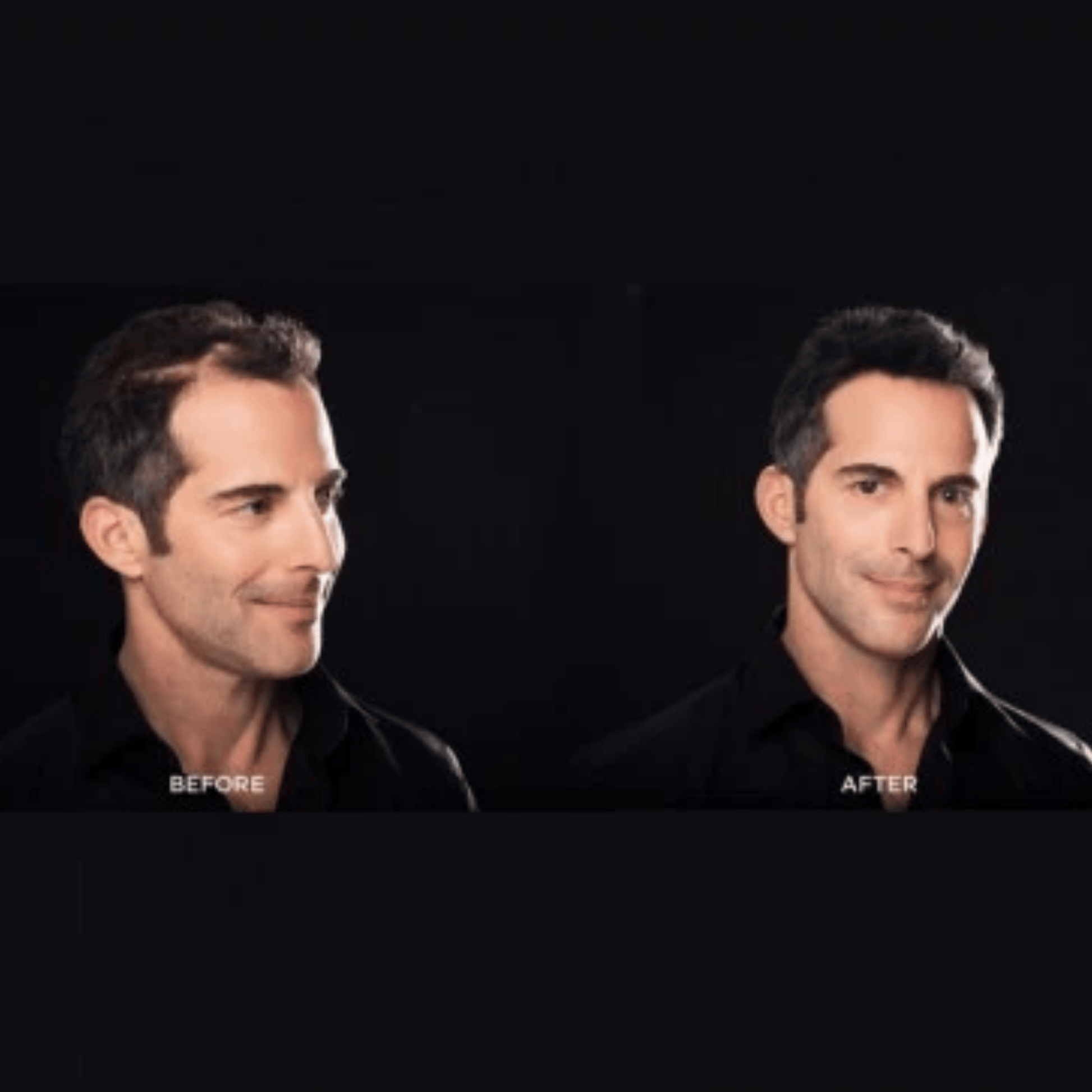 Toppik Hair Building Fibers (12g) USA Variant SkinStash