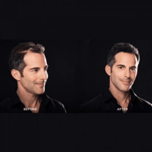 Toppik Hair Building Fibers (12g) USA Variant SkinStash